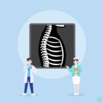 척추 갈비뼈 엑스레이 일러스트 ai 다운로드 download spine rib x-ray vector